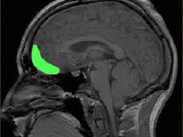 Why Teens Are Impulsive, Addiction-Prone And Should Protect Their Brains