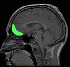 Why Teens Are Impulsive, Addiction-Prone And Should Protect Their Brains
